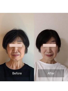 かぐや(salon)/ビフォーアフターのお写真