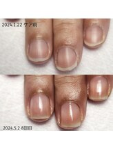 エヌプラス(Nplus)/美爪育成３ヵ月コース