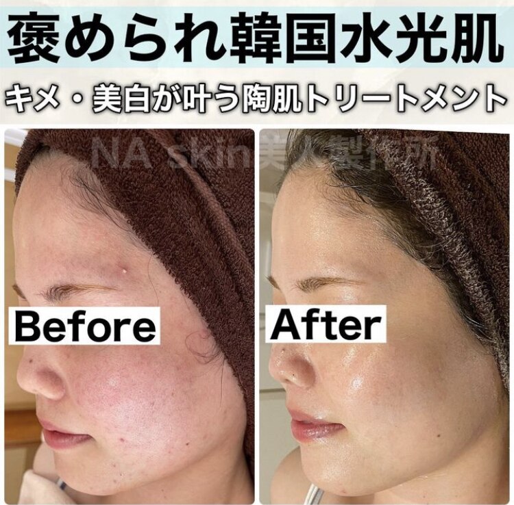 センター北駅で美肌が人気のエステサロン｜ホットペッパービューティー