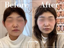 R-1ビューティーサロン 表参道/Before＆After