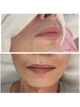 グランデ(Grande)/濃いヒゲにも