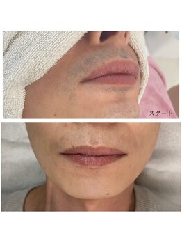 グランデ(Grande)/濃いヒゲにも