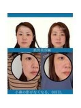 ハリラボ 仙台上杉店(hari Lab.)/【お客様の声】