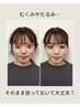 姿勢から整える小顔整体フルコース+ダイエットカウンセリング