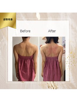 ロココ 町田店(Rococo)/姿勢改善でアンダーすっきり♪