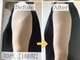 ヨサパーク エテノア(YOSAPARK etenoa)の写真/年齢とともに変わる体型に寄り添う大人女性のための痩身★この夏素敵にノースリーブを着こなせる二の腕へ♪