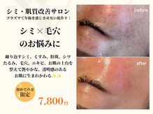 ココビ(COCOVi)