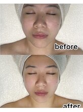 キノ(Kino)/蓄熱小顔basic