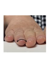 シープラス/爪のアーチ