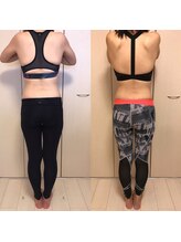 カロン(Kalon)/ボディスカルプトSE★モニター様