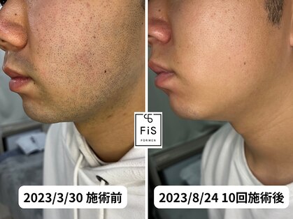 フィズ 多摩センター店(FIS)の写真