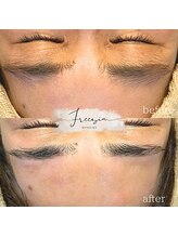 フリージア(Freesia)/Faicial waxとハーブピーリング