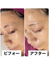 ビューティーサロン キャンディ 海老名(Candy)/