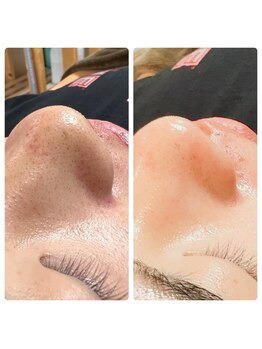 リバイバル(Re:vival)/毛穴汚れもスッキリ◎