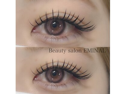 エミナル(EMINAL)の写真