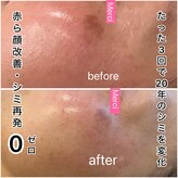 メルスィ 千歳店