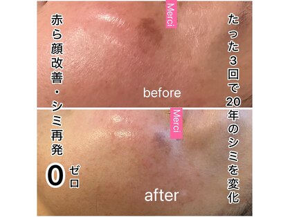 メルスィ 千歳店の写真