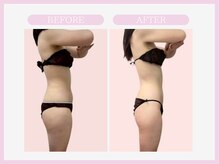 スリムライン 青森店(The Slim Line)/before→after