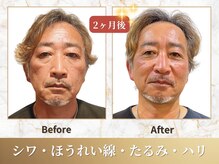 ビーシャルム(b.ChaRme)の雰囲気（【韓国発最新】リピーター様続出★シャルム独自のケアで別人級！）