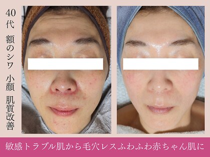 エボルブ 四条烏丸店(EVOLVE)の写真