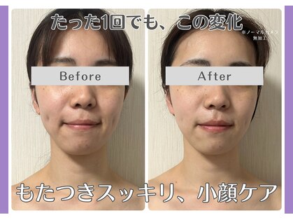 ルリアン(Lurian)の写真