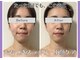 ルリアン(Lurian)の写真
