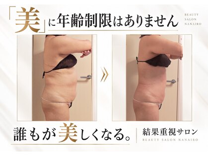 ナナイロ(nanairo)の写真