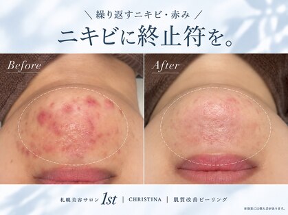 ファースト(1st)の写真