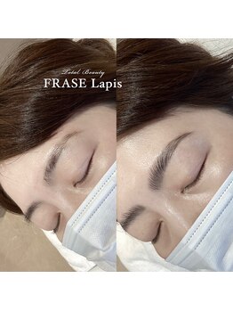 フレイズラピス(FRASE Lapis)/【ハリウッドブロウリフト】