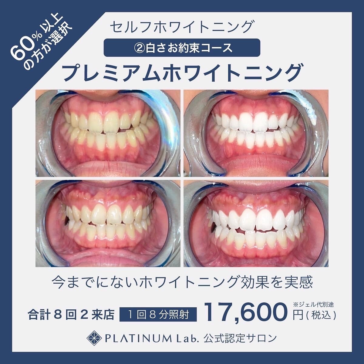 深緑(ふかみどり) 【新品未使用】セルフホワイトニング プラチナム