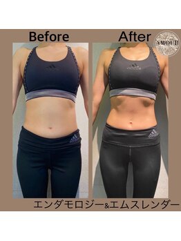 アムール 麻布十番(Amour)/エンダモロジー&エムスレンダー