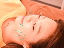 マイアート(My Art)/リフトアップやむくみ改善