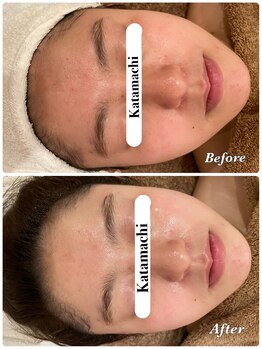 メナードフェイシャルサロン 片町店/新発売!最新ラインズLRパック