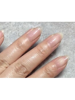 爪の悩みを解消できる（ケア含む）