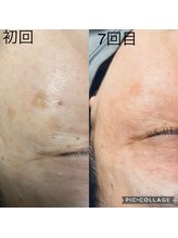 ビューティーサロン キャンディ 海老名(Candy)/