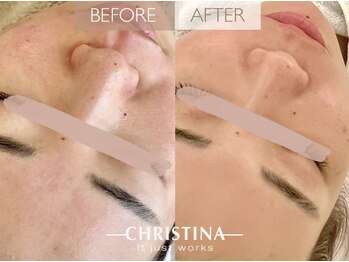 サロンブランシュ(salon BLANCHE)/自ら潤うトラブルレスな艶肌へ♪