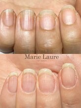 マリーロール 天王寺店(Marie Laure)/自爪育成/深爪矯正/ネイルケア