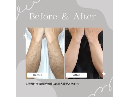 グレイス(Grace)の写真
