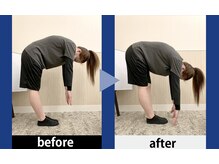 浜松整体 理学ゼーション 富塚店/ビフォーアフター