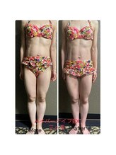 チュラ/ハイパーナイフ/所沢/痩身エステ