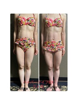 チュラ/ハイパーナイフ/所沢/痩身エステ