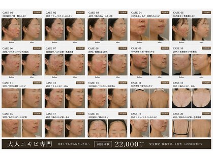 ホクビューティー(HOCU BEAUTY)の写真