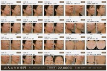 ホクビューティー(HOCU BEAUTY)