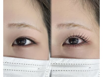 ヨーロー(YOLO)の写真