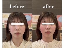 うらら骨盤整体 長浜院/小顔矯正