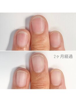 リモネイル(Rimo nail)/爪育成　自爪風仕上げ