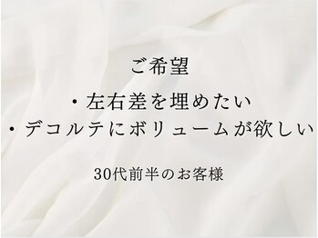 ソワ(soie)/ハリのある上向きバスト
