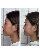 美緑/【自信が持てる】超小顔に大変身