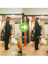 サプライズ整体院/30代ママさんの巻き肩初回結果