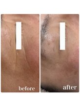 ブランシュムーニー(BRANCHE MOONY)/男性のお客様もキレイに！